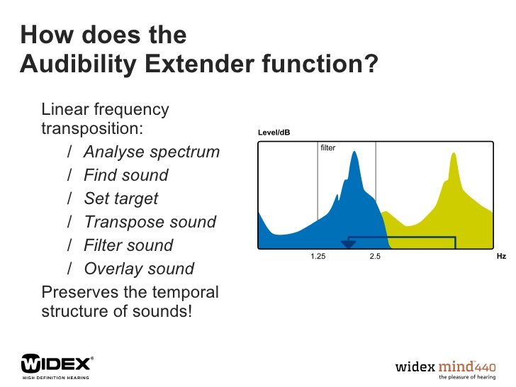 Widex Audibility Extender Frequency transposition.