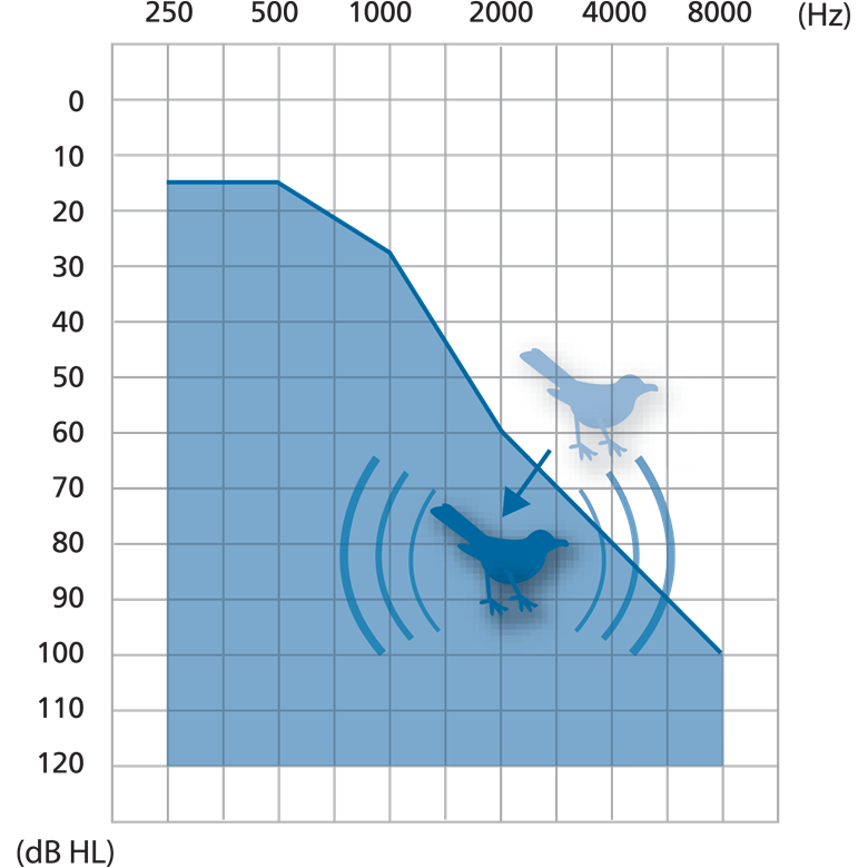 Widex Audibility Extender Example