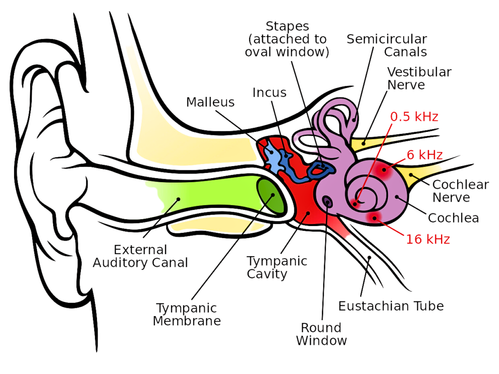 Sensorineural Hearing Loss in the Cochlea Pic.