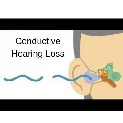 Conductive Hearing Loss